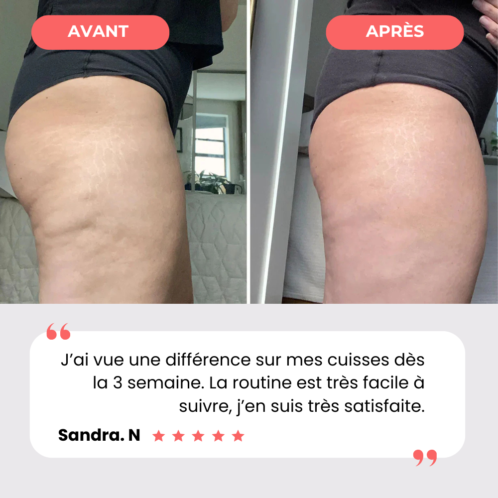 Appareil de massage anti-cellulite - Celliova