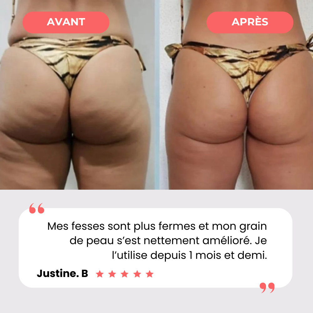 Appareil de massage anti-cellulite - Celliova