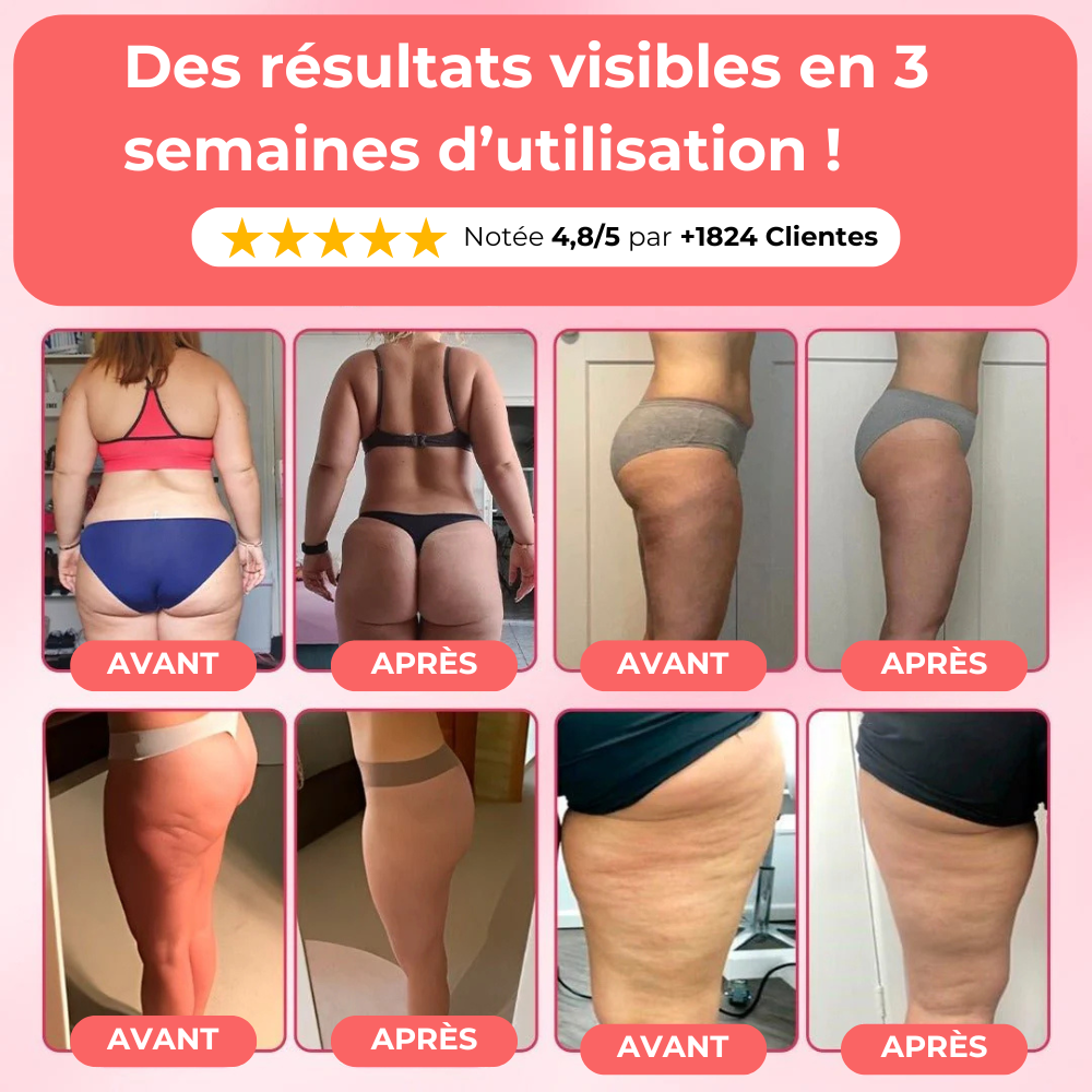 Appareil de massage anti-cellulite - Celliova