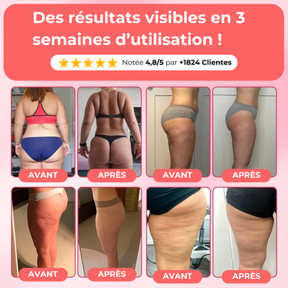 Appareil de massage anti-cellulite - Celliova